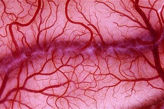 Angiogenesis: аневризма чаще поражает «слабые места» артерий